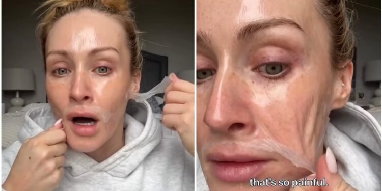 Σάλος με μάσκα «skincare»: Influencer «σφάδαζε» απ’ τον πόνο κατά την αφαίρεση της (vid)