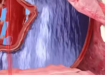 Τρομακτική προσομοίωση: Τι θα συνέβαινε αν πίναμε υπερβολική ποσότητα νερού