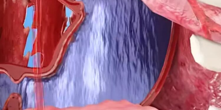 Τρομακτική προσομοίωση: Τι θα συνέβαινε αν πίναμε υπερβολική ποσότητα νερού